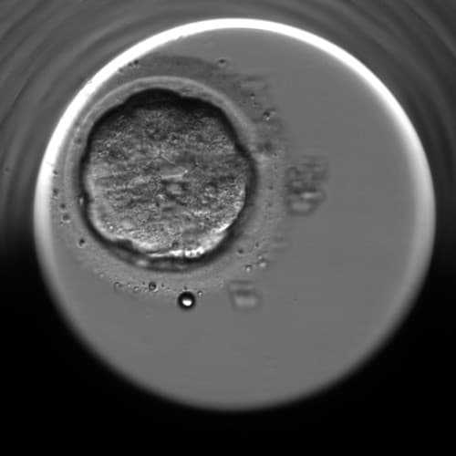 IVF-Garantie – Embryonen- und Eizellgarantien bei IVF mit Eizellspende erklärt