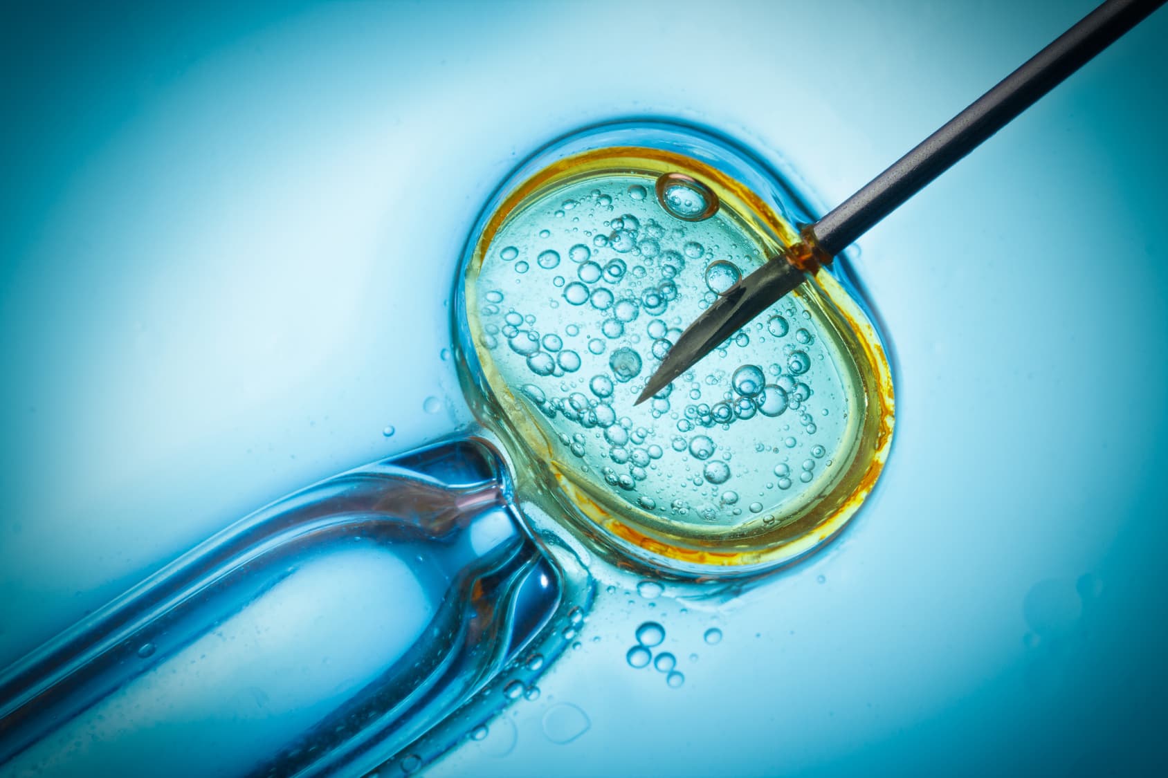 Frische oder gefrorene Spendereizellen bei IVF: Welche Option ist besser?