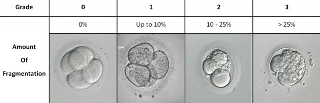 IVF embryo development - fragmentation grade