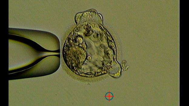 IVF embryo development - Koala - photo