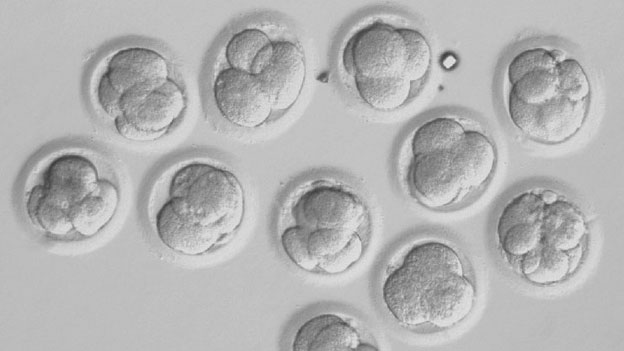 IVF embryo development - microscope look